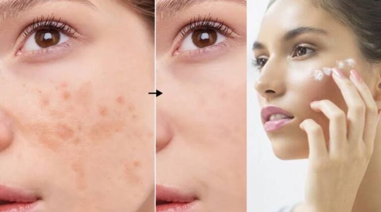 Can Kojic Acid Permanently Lighten Skin